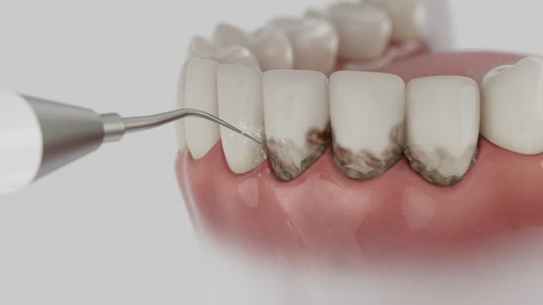 Reliable Tooth Extraction contractor in Lewisville, NC by Smile Center Dentistry
